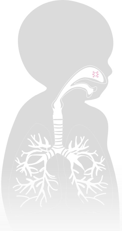 Image Voies respiratoires encombrées